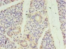 Immunohistochemistry of paraffin-embedded human pancreatic tissue using STRADB Antibody at dilution of 1:100Rabbit anti-Human STRADB Polyclonal Antibody