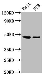 Western Blot | Positive WB detected in: Raji whole cell lysate, PC-3 whole cell lysate | All lanes: STRADB antibody at 3μg/ml | Secondary | Goat polyclonal to rabbit IgG at 1/50000 dilution | Predicted band size: 48, 43, 32 kDa | Observed band size: 48 kDaRabbit anti-Human STRADB Polyclonal Antibody