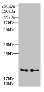 Western blot | All lanes: C20orf27 antibody at 6μg/ml | Lane 1: HCT116 whole cell lysate | Lane 2: MDA-MB-231 whole cell lysate | Secondary | Goat polyclonal to rabbit IgG at 1/10000 dilution | Predicted band size: 20, 22 kDa | Observed band size: 20 kDa