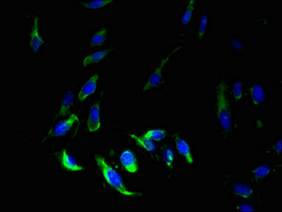 Immunofluorescent analysis of Hela cells using MS4A7 Antibody at dilution of 1:100 and Alexa Fluor 488-congugated AffiniPure Goat Anti-Rabbit IgG(H+L)Rabbit anti-Human MS4A7 Polyclonal Antibody