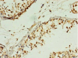 Immunohistochemistry of paraffin-embedded human testis tissue using MIS12 Antibody at dilution of 1:100
