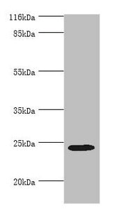 Western blot | All lanes: MIS12 antibody at 2μg/ml + Hela whole cell lysate | Secondary | Goat polyclonal to rabbit IgG at 1/10000 dilution | Predicted band size: 25 kDa | Observed band size: 25 kDa