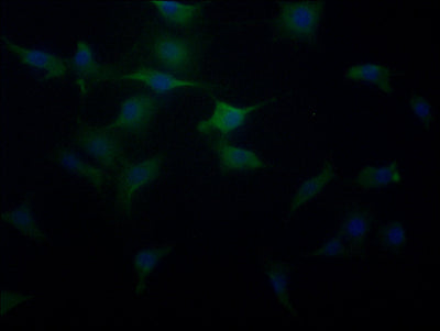 Immunofluorescence staining of MCF-7 cells with SLC25A51 Antibody at 1:100, counter-stained with DAPI. The cells were fixed in 4% formaldehyde, permeabilized using 0.2% Triton X-100 and blocked in 10% normal Goat Serum. The cells were then incubated with the antibody overnight at 4°C. The secondary antibody was Alexa Fluor 488-congugated AffiniPure Goat Anti-Rabbit IgG(H+L).Rabbit anti-Human SLC25A51 Polyclonal Antibody