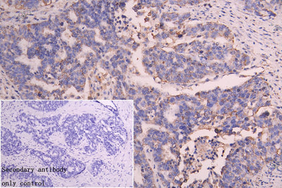 IHC image of SLC25A51 Antibody diluted at 1:100 and staining in paraffin-embedded human skeletal muscle tissue performed on a Leica BondTM system. After dewaxing and hydration, antigen retrieval was mediated by high pressure in a citrate buffer (pH 6.0). Section was blocked with 10% normal goat serum 30min at RT. Then primary antibody (1% BSA) was incubated at 4°C overnight. The primary is detected by a Goat anti-rabbit polymer IgG labeled by HRP and visualized using 0.05% DAB.Rabbit anti-Human SLC25A51 Polyclonal Antibody