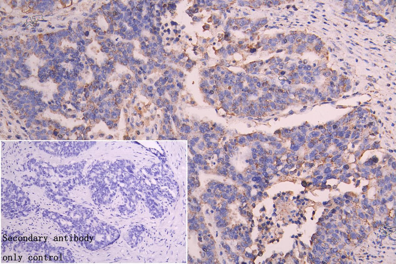 IHC image of SLC25A51 Antibody diluted at 1:100 and staining in paraffin-embedded human skeletal muscle tissue performed on a Leica BondTM system. After dewaxing and hydration, antigen retrieval was mediated by high pressure in a citrate buffer (pH 6.0). Section was blocked with 10% normal goat serum 30min at RT. Then primary antibody (1% BSA) was incubated at 4°C overnight. The primary is detected by a Goat anti-rabbit polymer IgG labeled by HRP and visualized using 0.05% DAB.Rabbit anti-Human SLC25A51 Polyclonal Antibody