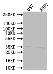 Western BlotPositive WB detected in: U87 whole cell lysate, K562 whole cell lysateAll lanes: SLC25A51 antibody at 1:1000SecondaryGoat polyclonal to rabbit IgG at 1/50000 dilutionPredicted band size: 34 kDaObserved band size: 35 kDaRabbit anti-Human SLC25A51 Polyclonal Antibody