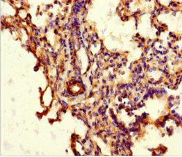 Immunohistochemistry of paraffin-embedded human lung tissue using the antibody at dilution of 1:100