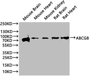 Western Blot | Positive WB detected in: Mouse heart tissue, Mouse lung tissue, Mouse kidney tissue, Mouse stomach tissue | All lanes: ABCG8 antibody at 2.8μg/ml | Secondary | Goat polyclonal to rabbit IgG at 1/50000 dilution | Predicted band size: 76 kDa | Observed band size: 76 kDa