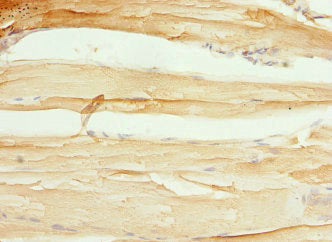 Immunohistochemistry of paraffin-embedded human skeletal muscle tissue using CXXC4 Antibody at dilution of 1:100Rabbit anti-Human CXXC4 Polyclonal Antibody