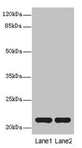 Western blot | All lanes: CXXC4antibody at 3.6μg/ml | Lane 1: Mouse liver tissue | Lane 2: Mouse kidney tissue | Secondary | Goat polyclonal to rabbit IgG at 1/10000 dilution | Predicted band size: 21 kDa | Observed band size: 21 kDaRabbit anti-Human CXXC4 Polyclonal Antibody