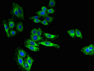 Immunofluorescent analysis of HepG2 cells using SLC6A15 Antibody at dilution of 1:100 and Alexa Fluor 488-congugated AffiniPure Goat Anti-Rabbit IgG(H+L)Rabbit anti-Human SLC6A15 Polyclonal Antibody