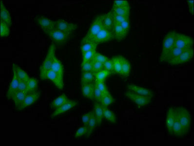 Immunofluorescence staining of HepG2 cells with MMADHC Antibody at 1:100, counter-stained with DAPI. The cells were fixed in 4% formaldehyde, permeabilized using 0.2% Triton X-100 and blocked in 10% normal Goat Serum. The cells were then incubated with the antibody overnight at 4°C. The secondary antibody was Alexa Fluor 488-congugated AffiniPure Goat Anti-Rabbit IgG(H+L).Rabbit anti-Human MMADHC Polyclonal Antibody