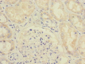 Immunohistochemistry of paraffin-embedded human kidney tissue using SAV1 Antibody at dilution of 1:100Rabbit anti-Human SAV1 Polyclonal Antibody