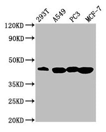 Western Blot  | Positive WB detected in: 293T whole cell lysate, A549 whole cell lysate, PC-3 whole cell lysate, MCF-7 whole cell lysate  | All lanes: SAV1 antibody at 3.64µg/ml  | Secondary  | Goat polyclonal to rabbit IgG at 1/50000 dilution  | Predicted band size: 45 kDa  | Observed band size: 45 kDaRabbit anti-Human SAV1 Polyclonal Antibody