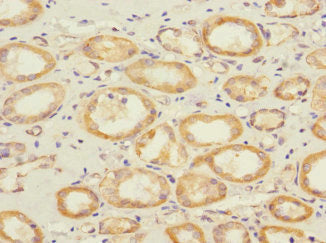 Immunohistochemistry of paraffin-embedded human kidney tissue using SAV1 Antibody at dilution of 1:100Rabbit anti-Human SAV1 Polyclonal Antibody