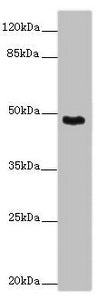 Western blot | All lanes: SMOC1 antibody at 14 μg/ml + Mouse skeletal muscle tissue | Secondary | Goat polyclonal to rabbit IgG at 1/10000 dilution | Predicted band size: 48 kDa | Observed band size: 48 kDaRabbit anti-Human SMOC1 Polyclonal Antibody