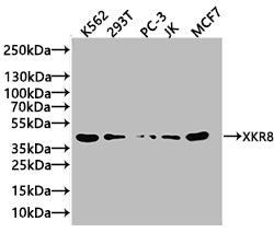 Western Blot  | Positive WB detected in: K562 whole cell lysate, 293T whole cell lysate  | All lanes: XKR8 antibody at 3.4µg/ml  | Secondary  | Goat polyclonal to rabbit IgG at 1/50000 dilution  | Predicted band size: 45 kDa  | Observed band size: 45 kDaRabbit anti-Human XKR8 Polyclonal Antibody