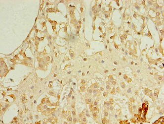 Immunohistochemistry of paraffin-embedded human adrenal gland tissue using REEP4 Antibody at dilution of 1:100Rabbit anti-Human REEP4 Polyclonal Antibody