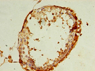 Immunohistochemistry of paraffin-embedded human testis tissue using REEP4 Antibody at dilution of 1:100Rabbit anti-Human REEP4 Polyclonal Antibody