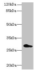 Western blot | All lanes: REEP4 antibody at 0.7μg/ml + U251 whole cell lysate | Secondary | Goat polyclonal to rabbit IgG at 1/10000 dilution | Predicted band size: 30, 20 kDa | Observed band size: 30 kDaRabbit anti-Human REEP4 Polyclonal Antibody