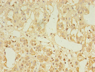 Immunohistochemistry of paraffin-embedded human adrenal gland tissue using LDAH Antibody at dilution of 1:100
