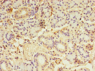 Immunohistochemistry of paraffin-embedded human pancreatic tissue using LDAH Antibody at dilution of 1:100