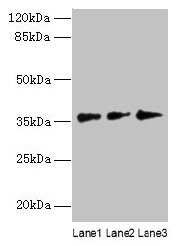 Western blot  | All lanes: LDAH antibody at 8µg/ml  | Lane 1: Hela whole cell lysate  | Lane 2: Jurkat whole cell lysate  | Lane 3: A431 whole cell lysate  | Secondary  | Goat polyclonal to rabbit IgG at 1/10000 dilution  | Predicted band size: 38, 33, 23 kDa  | Observed band size: 38 kDa