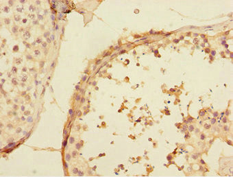 Immunohistochemistry of paraffin-embedded human testis tissue using UBE2Z Antibody at dilution of 1:100Rabbit anti-Human UBE2Z Polyclonal Antibody