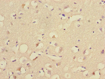 Immunohistochemistry of paraffin-embedded human brain tissue using UBE2Z Antibody at dilution of 1:100Rabbit anti-Human UBE2Z Polyclonal Antibody