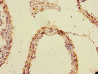 Immunohistochemistry of paraffin-embedded human testis tissue using UBE2Z Antibody at dilution of 1:100Rabbit anti-Human UBE2Z Polyclonal Antibody
