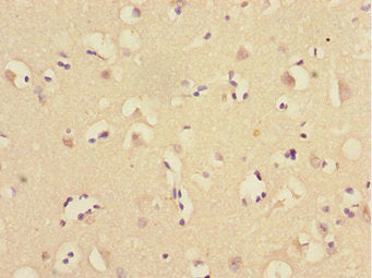 Immunohistochemistry of paraffin-embedded human brain tissue using UBE2Z Antibody at dilution of 1:100Rabbit anti-Human UBE2Z Polyclonal Antibody