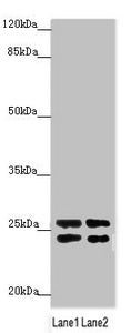 Western blot  | All lanes: GRPEL1 antibody at 2.65µg/ml  | Lane 1: A431 whole cell lysate  | Lane 2: 293T whole cell lysate  | Secondary  | Goat polyclonal to rabbit IgG at 1/10000 dilution  | Predicted band size: 24 kDa  | Observed band size: 24, 26 kDaRabbit anti-Human GRPEL1 Polyclonal Antibody