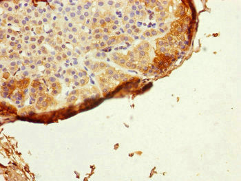 Immunohistochemistry of paraffin-embedded human adrenal gland tissue using GRPEL1 Antibody at dilution of 1:100Rabbit anti-Human GRPEL1 Polyclonal Antibody