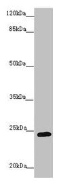 Western blot  | All lanes: GRPEL1 antibody at 1.37µg/ml + 293T whole cell lysate  | Secondary  | Goat polyclonal to rabbit IgG at 1/10000 dilution  | Predicted band size: 24 kDa  | Observed band size: 24 kDaRabbit anti-Human GRPEL1 Polyclonal Antibody