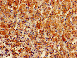Immunohistochemistry of paraffin-embedded human adrenal gland tissue using GPAM Antibody at dilution of 1:100Rabbit anti-Human GPAM Polyclonal Antibody
