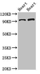 Western Blot | Positive WB detected in: Rat heart tissue, Mouse heart tissue | All lanes: GPAM antibody at 3.4μg/ml | Secondary | Goat polyclonal to rabbit IgG at 1/50000 dilution | Predicted band size: 94 kDa | Observed band size: 94 kDaRabbit anti-Human GPAM Polyclonal Antibody