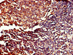 Immunohistochemistry of paraffin-embedded human tonsil tissue using the antibody at dilution of 1:100Rabbit anti-Human PDE11A Polyclonal Antibody