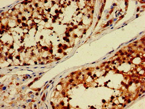 Immunohistochemistry of paraffin-embedded human testis tissue using PDE11A Antibody at dilution of 1:100Rabbit anti-Human PDE11A Polyclonal Antibody