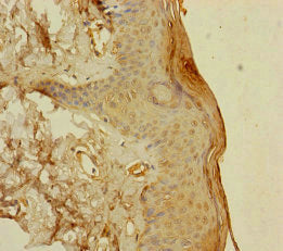 Immunohistochemistry of paraffin-embedded human skin tissue using S100A14 Antibody at dilution of 1:100Rabbit anti-Human S100A14 Polyclonal Antibody