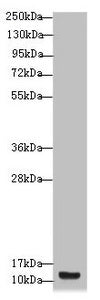 Western blot  | All lanes: S100A14 antibody at 4.11µg/ml + A431 whole cell lysate  | Secondary  | Goat polyclonal to rabbit IgG at 1/10000 dilution  | Predicted band size: 12 kDa  | Observed band size: 12 kDaRabbit anti-Human S100A14 Polyclonal Antibody