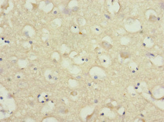 Immunohistochemistry of paraffin-embedded human brain tissue using NRXN3 Antibody at dilution of 1:100Rabbit anti-Human NRXN3 Polyclonal Antibody