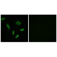 Immunofluorescence analysis of A549 cells, using SLC27A5 antibody.Rabbit anti-Human SLC27A5 Polyclonal Antibody
