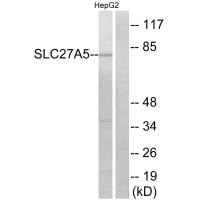 Western blot analysis of extracts from HepG2 cells, using SLC27A5 antibody.Rabbit anti-Human SLC27A5 Polyclonal Antibody