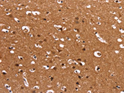 The image on the left is immunohistochemistry of paraffin-embedded Human brain  tissue using HDLBP Antibody(HDLBP Antibody) at dilution 1/50, on the right is treated with synthetic peptide. (Original magnification: X200)