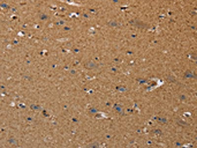 The image on the left is immunohistochemistry of paraffin-embedded Human brain  tissue using DDAH1 Antibody(DDAH1 Antibody) at dilution 1/50, on the right is treated with synthetic peptide. (Original magnification: ×200)Rabbit anti-Human DDAH1 Polyclonal Antibody