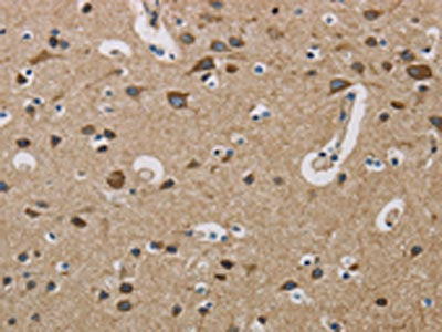 The image is immunohistochemistry of paraffin-embedded Human brain tissue using COX6B1 Antibody(COX6B1 Antibody) at dilution 1/50. (Original magnification: ×200)Rabbit anti-Human COX6B1 Polyclonal Antibody