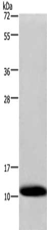 Gel: 10%SDS-PAGE,Lysate: 40 μg,,Primary antibody: COX6B1 Antibody(COX6B1 Antibody) at dilution 1/1200 dilution,Secondary antibody: Goat anti rabbit IgG at 1/8000 dilution,Exposure time: 1 minuteRabbit anti-Human COX6B1 Polyclonal Antibody