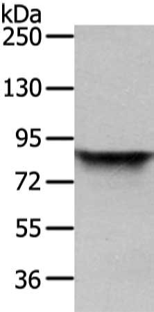 Gel: 6%SDS-PAGE, Lysate: 40 μg, Lane: HT-29 cell, Primary antibody: VIL1 Antibody(VIL1 Antibody) at dilution 1/250 dilution, Secondary antibody: Goat anti rabbit IgG at 1/8000 dilution, Exposure time: 3 secondsRabbit anti-Human VIL1 Polyclonal Antibody