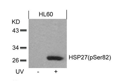 Western blot analysis of extracts from HL60 cells untreated or treated with UV using HSP27(Phospho-Ser82) Antibody.Rabbit anti-Human HSPB1 Polyclonal Antibody