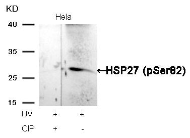 Western blot analysis of extracts from Hela cells, treated with UV or calf intestinal phosphatase (CIP), using HSP27 (Phospho-Ser82) Antibody.Rabbit anti-Human HSPB1 Polyclonal Antibody